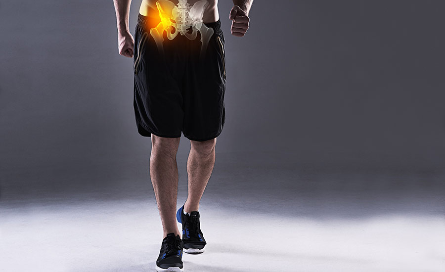 Most Common Hip Injuries, Symptoms & Treatment 